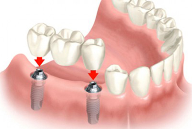 D5-symptoms-smiling-couple-general-dentistry